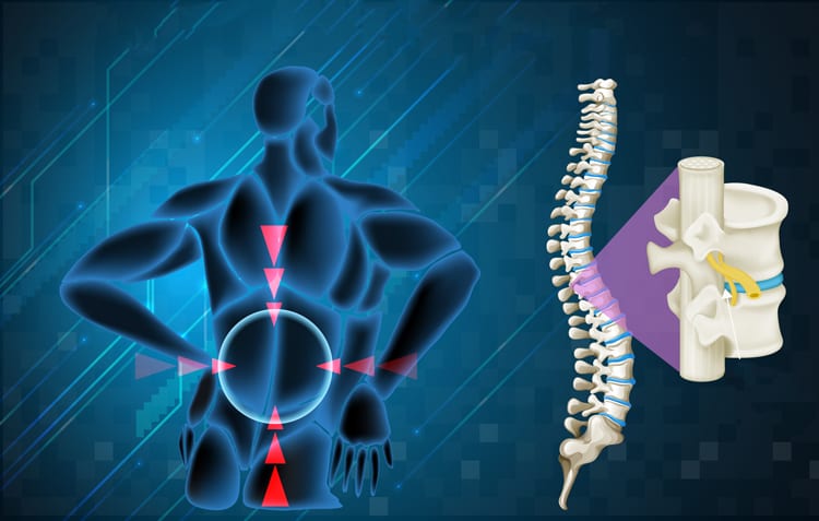 Spinal Cord Stimulation - Διέγερση Νωτιαίου Μυελού